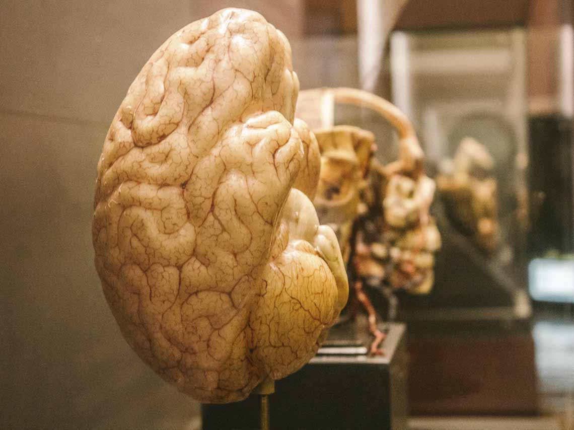 Exposicion-de-medicina-en-el-palacio-de-la-escuela-de-medicina-sobre-el-cuerpo-humano-a-capite-ad-calcem-figura-de-cera-color-cerebro-modelo
