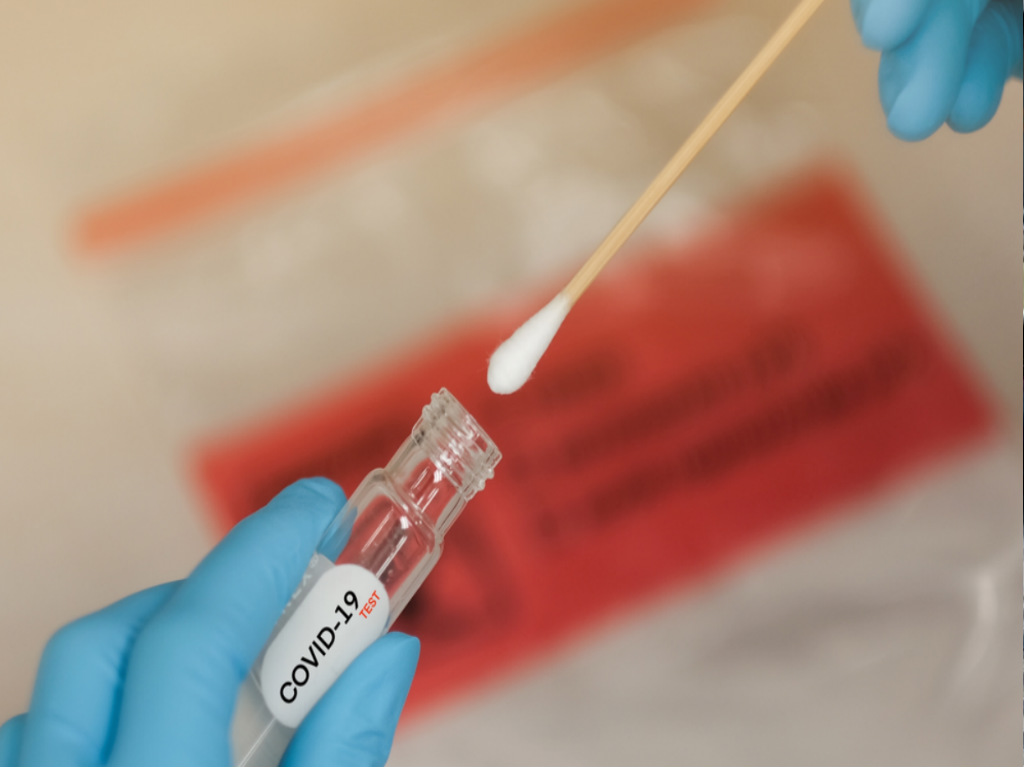 Buscan aplicar más de 100 mil pruebas de COVID-19 en CDMX