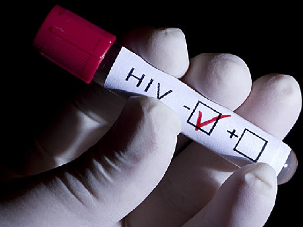 Vacuna contra el VIH prueba