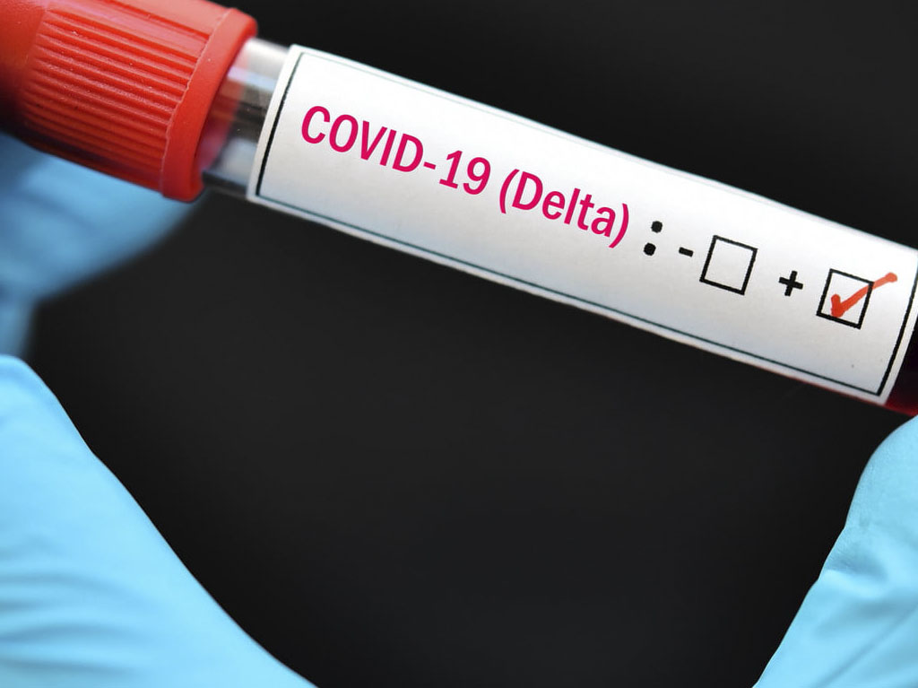 Variante Delta de COVID-19: más contagiosa y letal