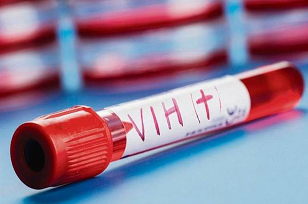 ¡Atención! Harán pruebas de VIH y Sífilis gratis en CDMX 1
